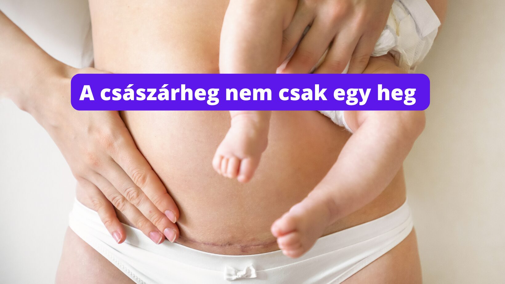 A császárheg nem „csak egy heg”